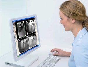 Dental X-Rays in Durham, NC